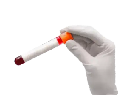 Lab Tests